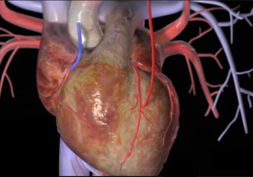 CABG PROCEDURE